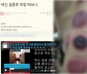 부항으로 백신 해독?..황당무계 '백신 가짜뉴스'