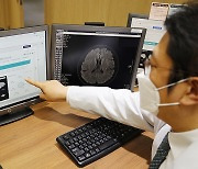 치매·뇌졸중도 AI로 진단한다.."정확도·효율성이 강점"