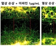 벌독 정제한 '봉침', 신경세포 재생 효과 있다