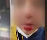 [단독] 유명 전직 카레이서, 8살 아이 발로 차고 '내동댕이'..경찰 수사