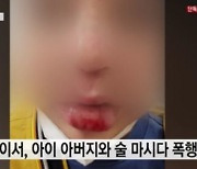 전직 유명 카레이서, 8살 아동 폭행·내동댕이 "앞니 빠져"