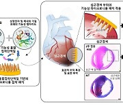 '홍합 접착 단백질'로 이 질환 치료 가능해진다