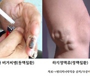 선생님! 요즘 혈액순환이 잘 안 돼요. 이것도 병일까요? [의사에게 듣는 '질환' 이야기]