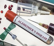 알츠하이머, 혈액으로 20분내 진단..日 기업 2023년 상용화