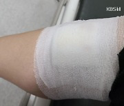 개에 물려 치료비 청구했더니.."협박하고 이용하냐" 적반하장