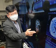 韓 기술로 'AI 의료시대' 개막 이끈다