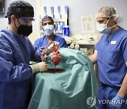 '돼지 심장' 사람 인체에 이식 첫 성공, 역사적 분수령 열려