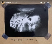 "22살 엄마가 33살 됐다"..박환희, 임신 일기+초음파 사진 공개