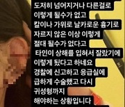 클럽 '귀 절단' 사건 CCTV 본 경찰 "술 취해 비틀거리지만.."