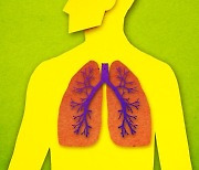 담배도 피우지 않는데 마른 기침·피로 생기는 희소 질환 '사르코이드증'