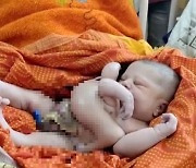 팔·다리 4개인 아기 탄생.."신의 현신" 인도가 발칵 뒤집혔다