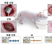 접착제 없이도 몸속에 센서를 붙인다