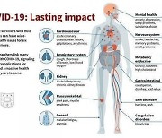 "코로나19 장기 후유증, 알츠하이머 신호일 수도"