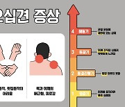 만세·뒷짐 동작 어려우면 '오십견' 의심해야