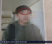 머리카락 잘리고 코뼈 휘었는데..교사는 "애들 장난이에요"