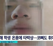 코뼈 휘고 머리카락 잘렸는데..교사는 "어머님, 애들 장난인데"