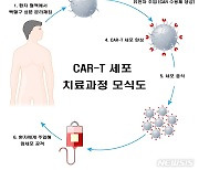 꿈의 항암제 'CAR-T', 혈액암→고형암 영역 확대
