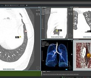 코어라인소프트, 독일·벨기에 대형병원에 AI 진단 솔루션 공급