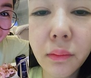 '한창♥' 장영란, 야식 후폭풍 제대로..퉁퉁 부은 얼굴 "후회 중"