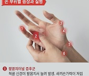 종일 키보드 치고 톡 날리는 당신, 컵들 때 손목 찌릿하면 이 증상