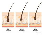 롱코비드 후유증 '탈모' 확산..초기 관리 중요