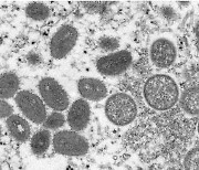 '이례적 확산세' 원숭이두창..WHO "여름철 감염 급증할 수도"