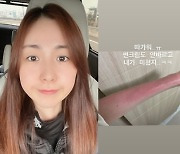 간미연, 심각한 상태의 팔뚝 화상.."내가 미쳤지"