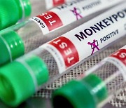 남아공 전문가들 "원숭이두창 대량 백신 접종 필요 없어"