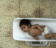 APTOPIX Afghanistan Malnutrition