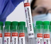 남아공 전문가들 "원숭이두창 대량 백신접종 필요 없어"