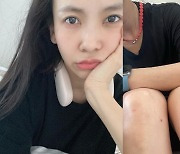 '레이먼킴♥' 김지우, 남의 차 긁는 사고 "다리에 피까지 나, 일진 엉망 징찬"