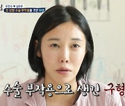 [종합] '이천수♥' 심하은 "성형 부작용으로 코 찌그러져..'성괴' 악플 마음의 상처" ('살림남2')