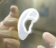 美의료팀, 환자 조직 이용 3D프린팅 귀 이식 성공