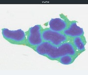뷰노, ASCO서 AI 기반 간암 디지털 바이오마커 연구 발표