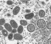'원숭이두창 의심증상' 미국인, 멕시코 병원 탈출해 본국서 확진