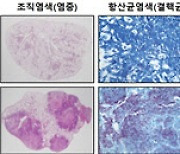 연세대 연구팀, 바이러스 감염으로 인한 결핵 악화 기전 규명