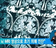 "인공지능, 뇌 MRI 영상으로 초기 치매 진단"