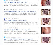 한국과학기자협회 "원숭이두창 보도 시 흑인환자 사진 사용 자제"