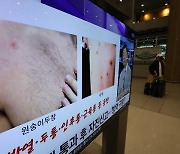 美CDC "원숭이두창 지역전파 확인..주로 남성간 성접촉"