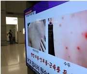 경기도, '원숭이두창' 비상대응 체계 가동..방역대책반·전담병원 등