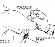 구형 두창 백신, 접종 까다롭고 이상반응 우려..3세대 도입해야