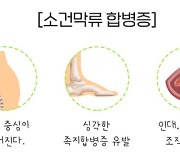 한국인에게 특히 자주 발생하는 '발' 질환이 있다?