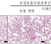 폐 손상을 방지하는 면역세포 폐 질환제어 가능성 규명