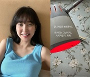 '안면마비' 최희, 끝 없는 재활 근황.."완치되는 날까지 지치지 말기"