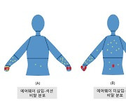 코로나19 환자 비말 분포 분석한 연구결과 나왔다