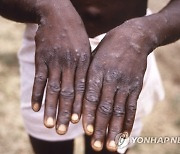 Africa Monkeypox