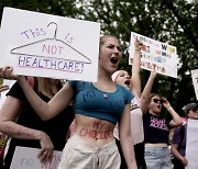 미 '임신중단권 폐기 판결'에 행동으로 맞선다