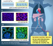 1시간 전 죽은 돼지 심장 다시 뛰게 했다