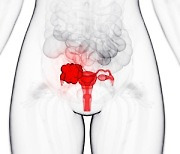 자궁내막암과 난소암에서 중요한 '유전자'는?