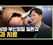 [약손+] 통합치과④ 갑상샘·부신피질 질환과 치과 치료